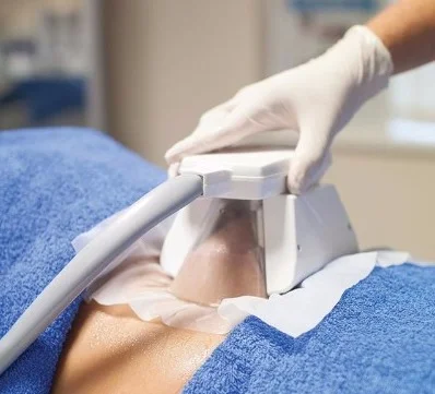 Freeze Fat Cell Treatment
