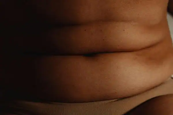 The Hidden Connection: How Stress Shapes Your Fitness and Body Composition 3 image of what stress can do on the stomach area and how Lipo 360 Worthing can help to change your body shape.